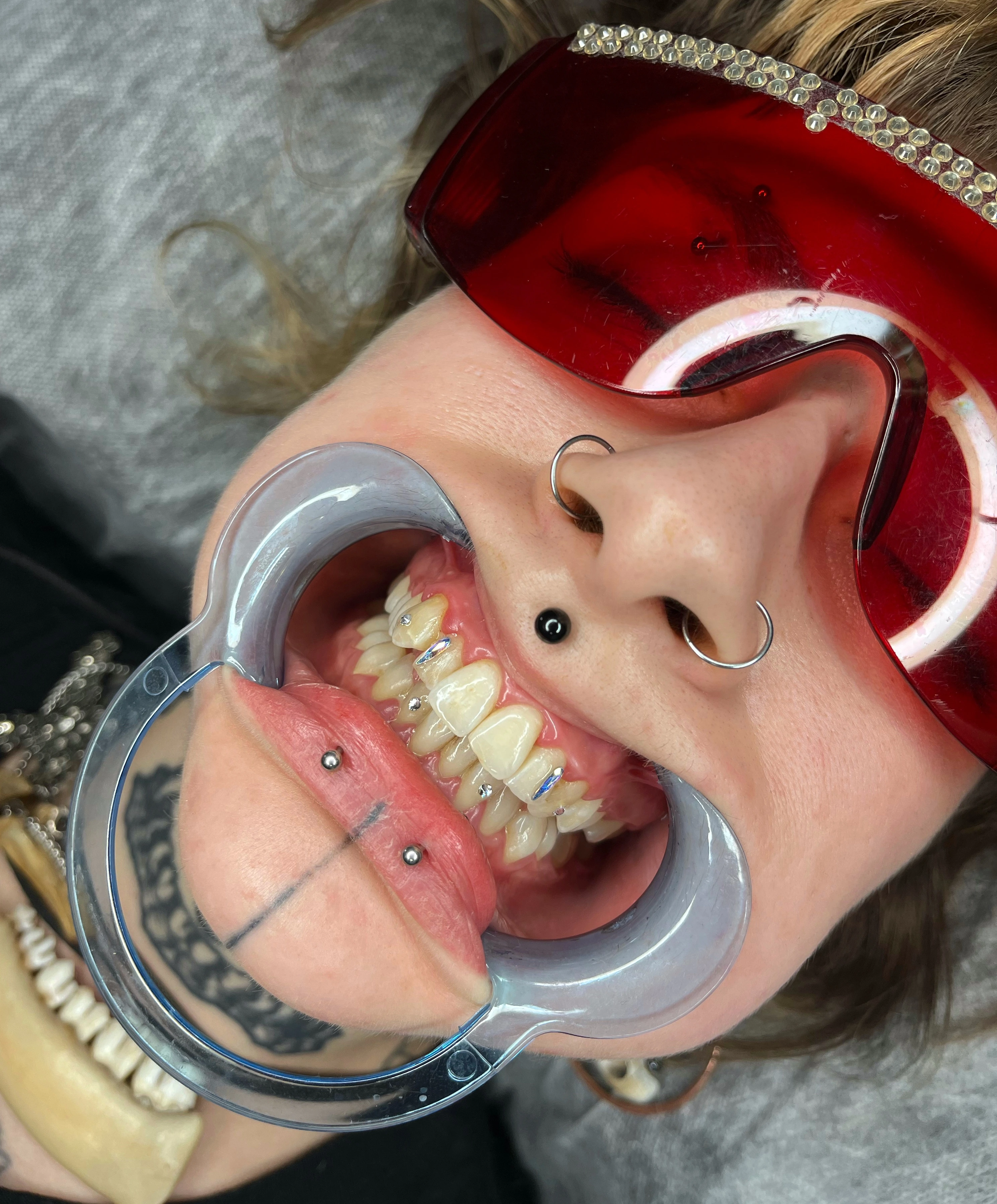 Efekt Toothgems - biżuteria nazębna