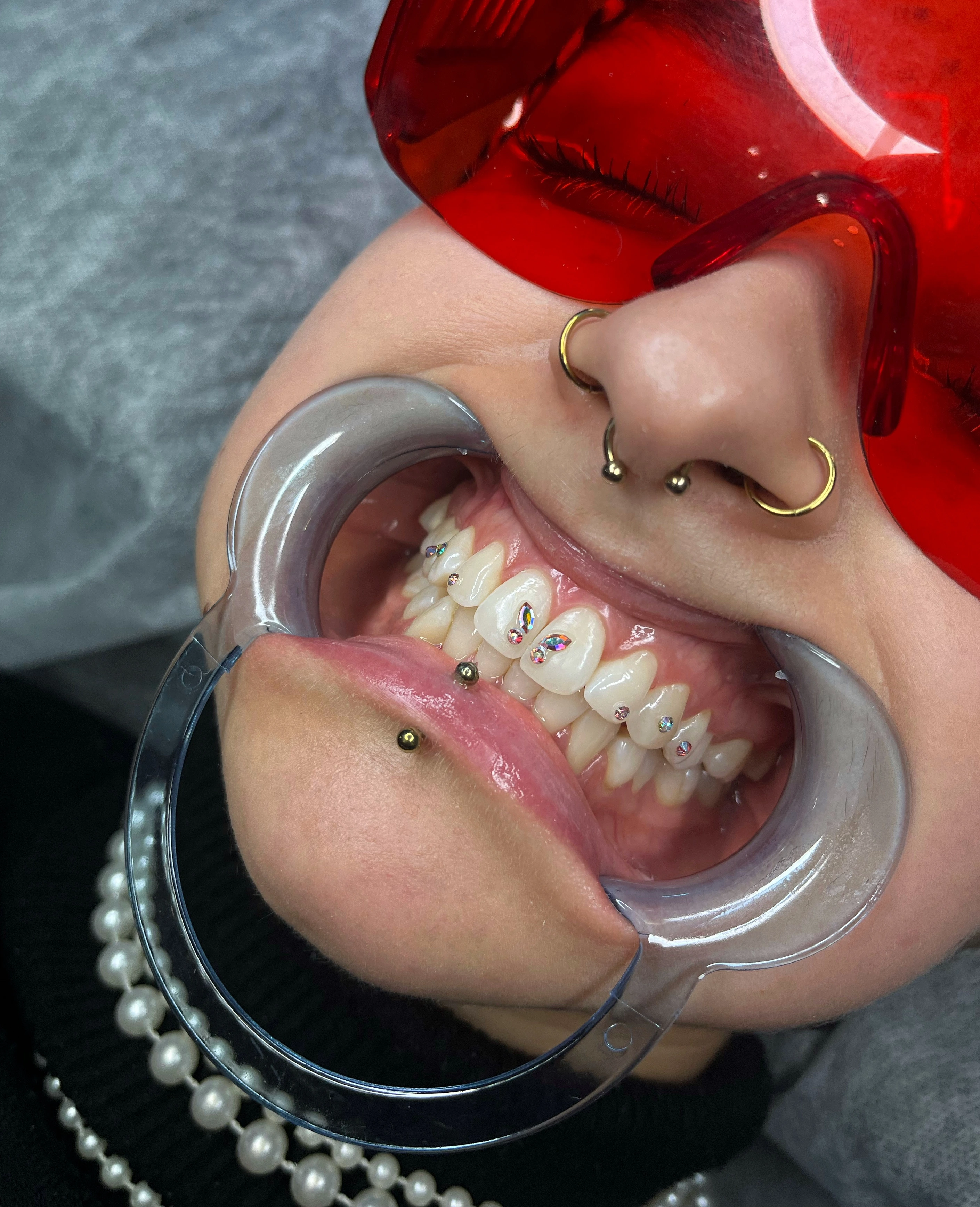 Efekt Toothgems - biżuteria nazębna