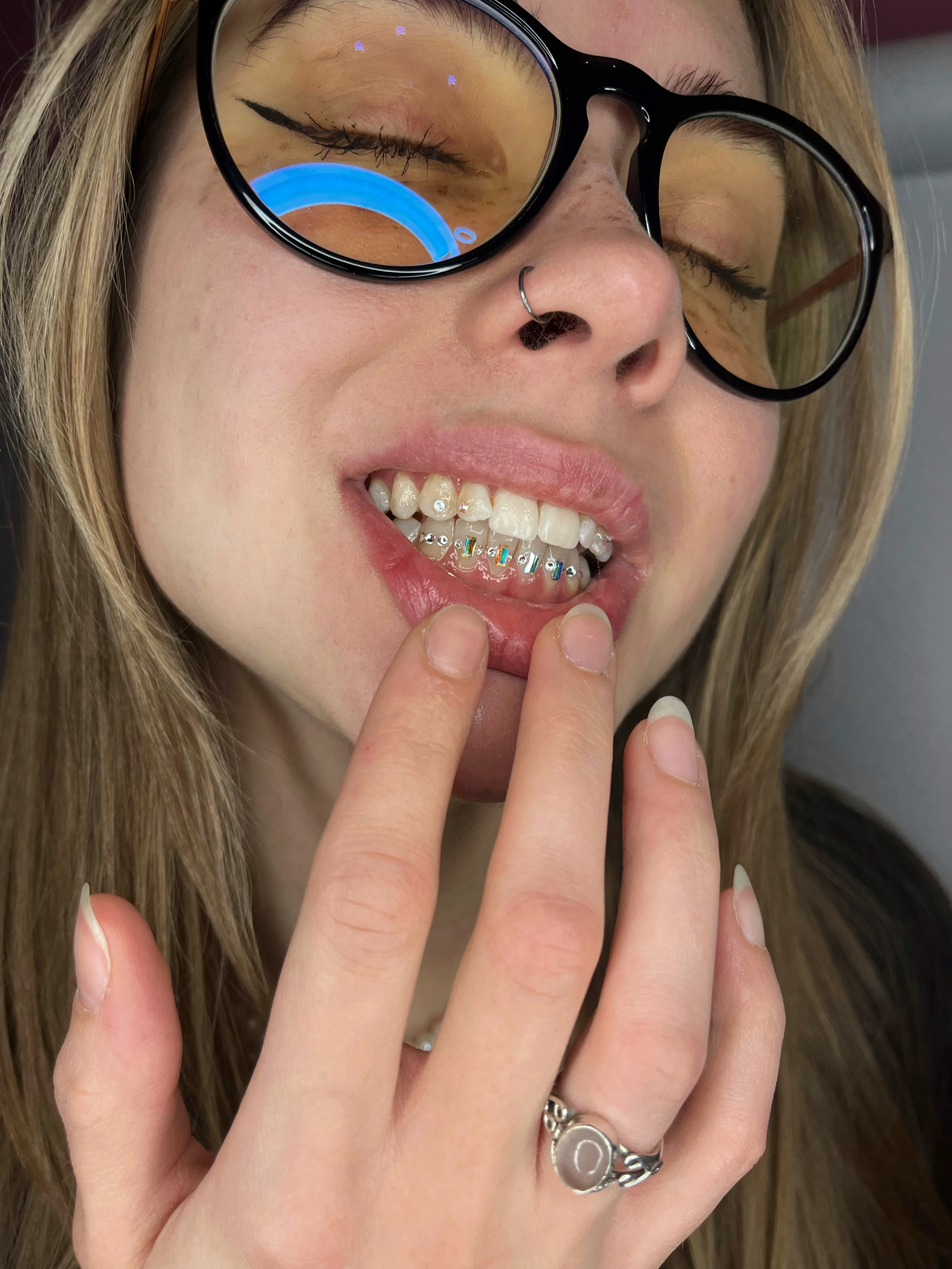 Efekt Toothgems - biżuteria nazębna